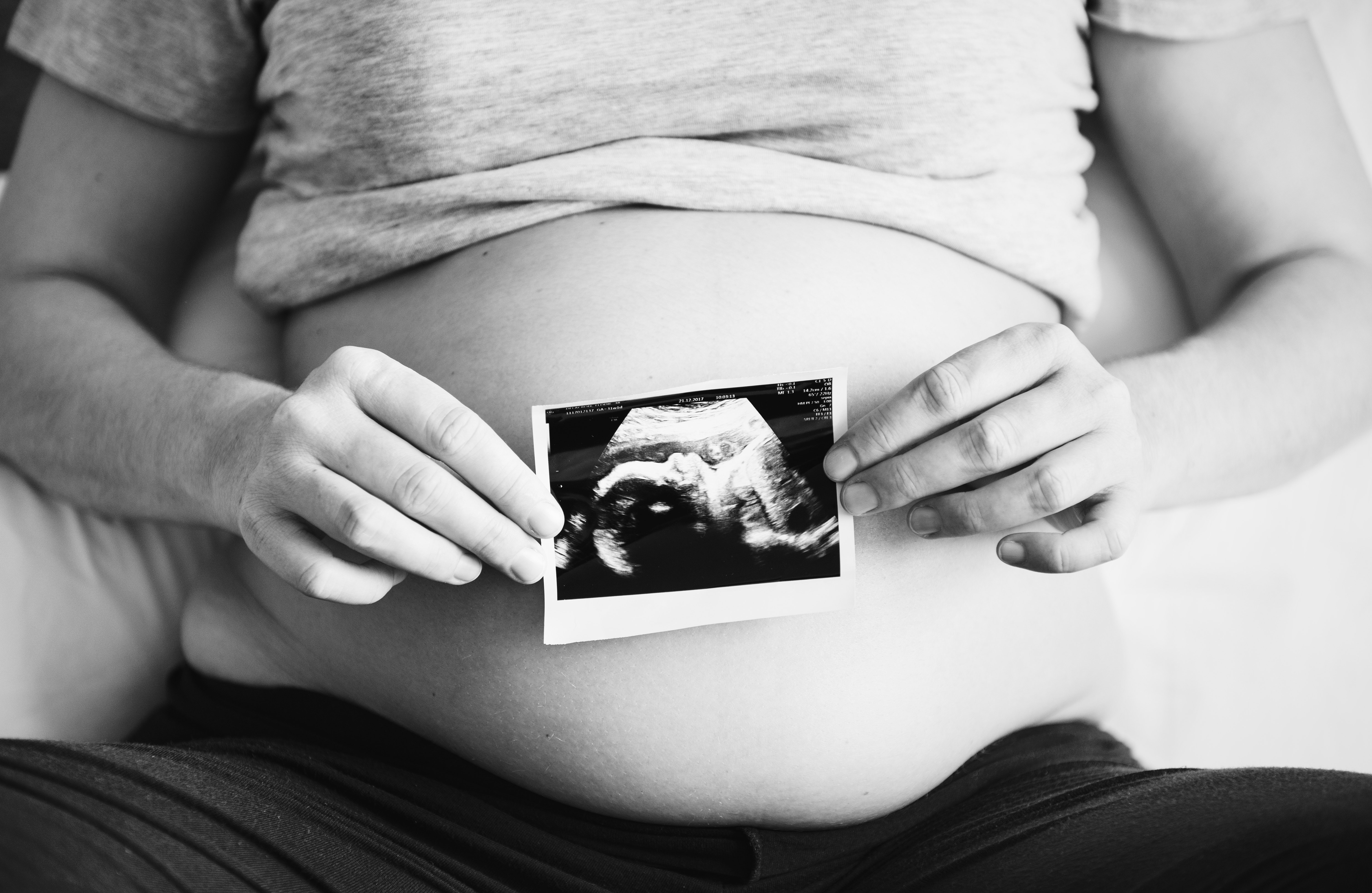 Pregnant woman showing scan picture