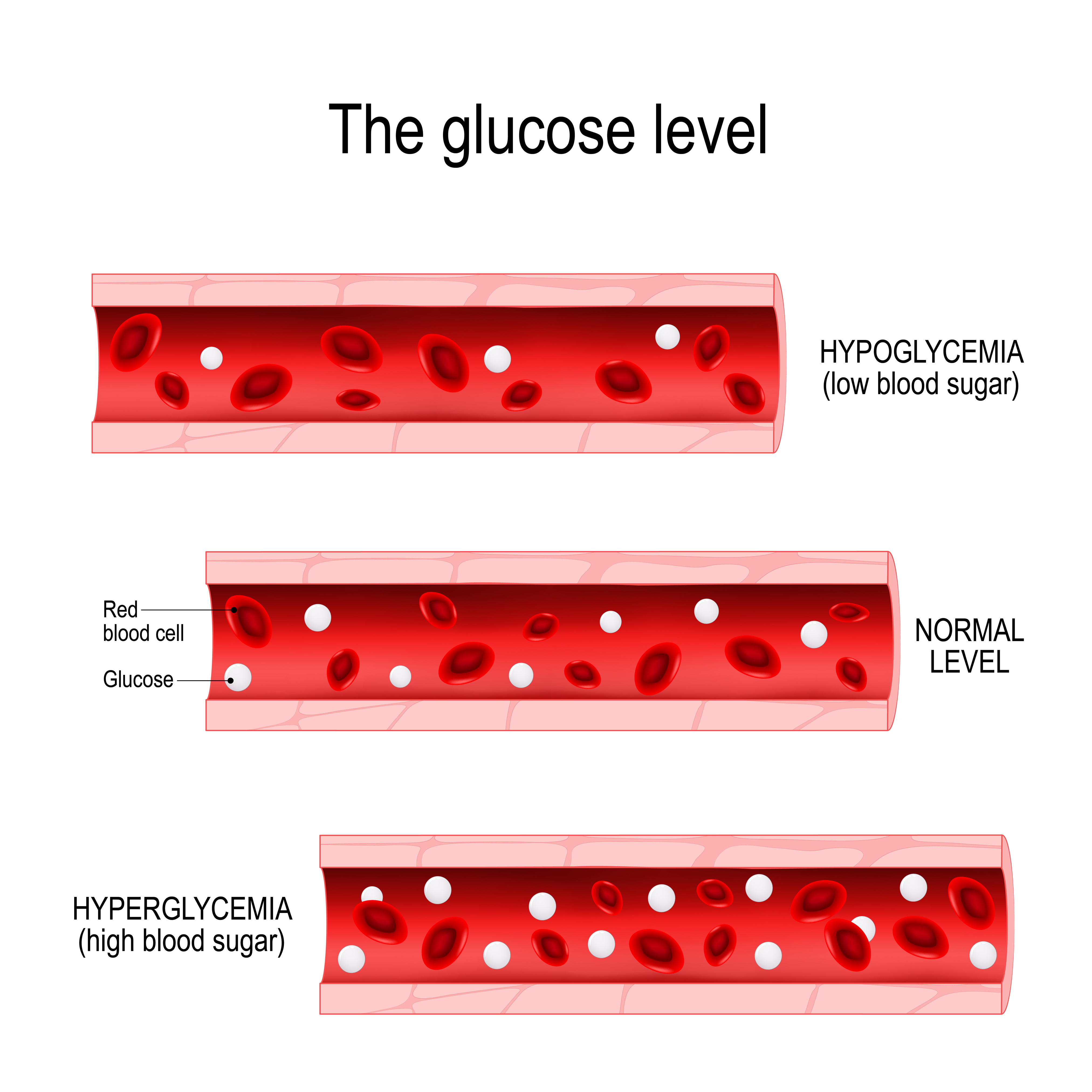 The glucose level diagram