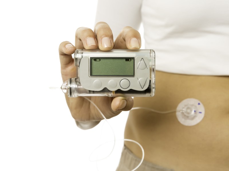 Someone wearing an insulin pump