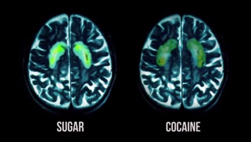 Scan showing the effect of sugar and cocaine on the brain