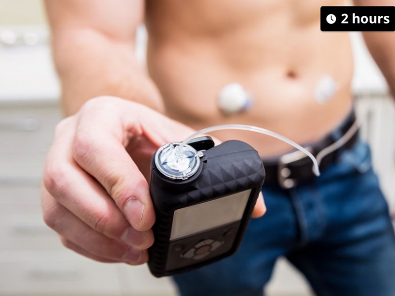 Someone wearing an insulin pump