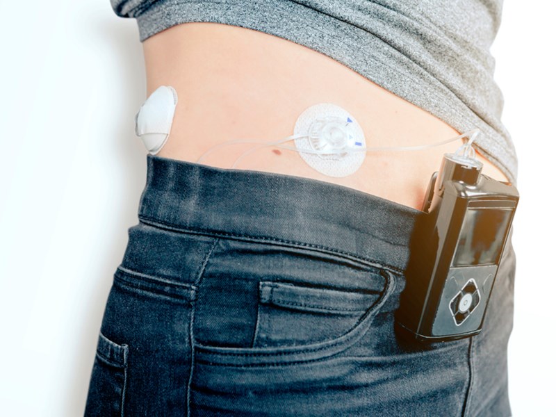 Hybrid Closed Loops (HCL): Mini Module